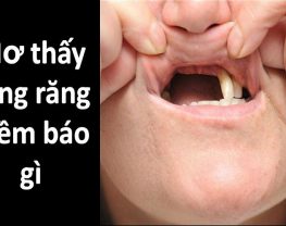 Giải mã giấc mơ rụng răng